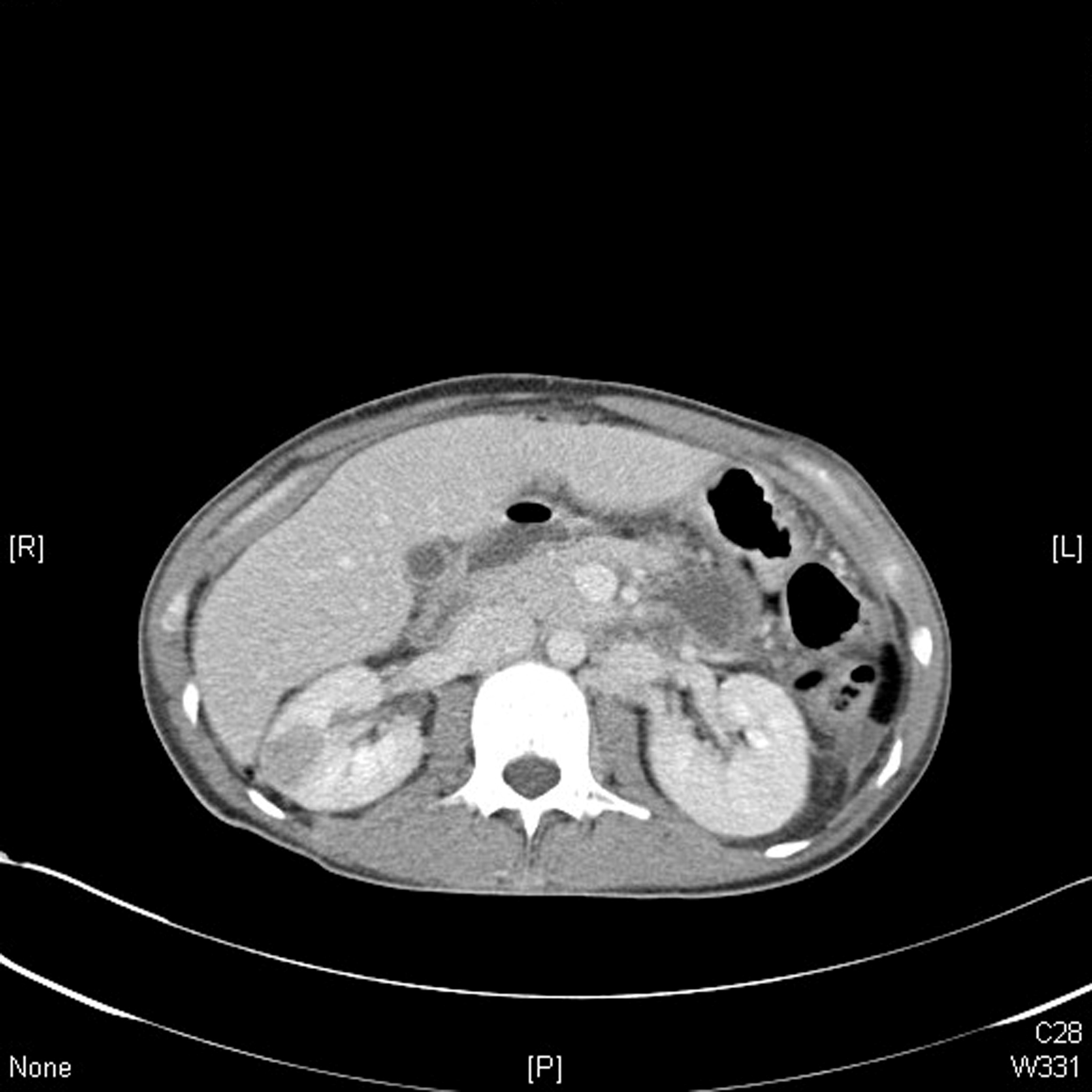 CT - fig 2